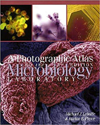 Image of 3rd edition: Leboffe & Pierce, 2005, Photographic Atlas for the Microbiology Laboratory, Morton Publishing Company, ISBN: 9780895826565