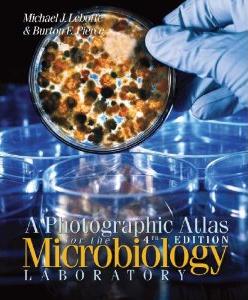 Image of Leboffe & Pierce, 2011, Photographic Atlas for the Microbiology Laboratory, 4th Edition, Morton Publishing Company, ISBN: 0895828723 